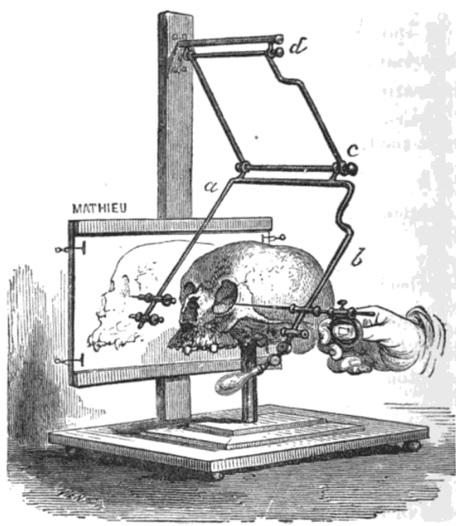 Stereograph